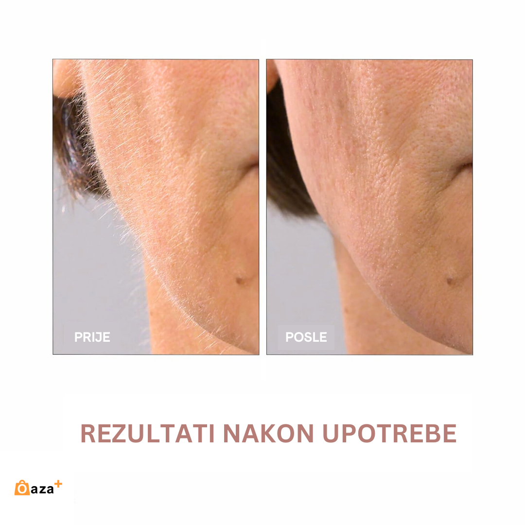 DERMAPLAME