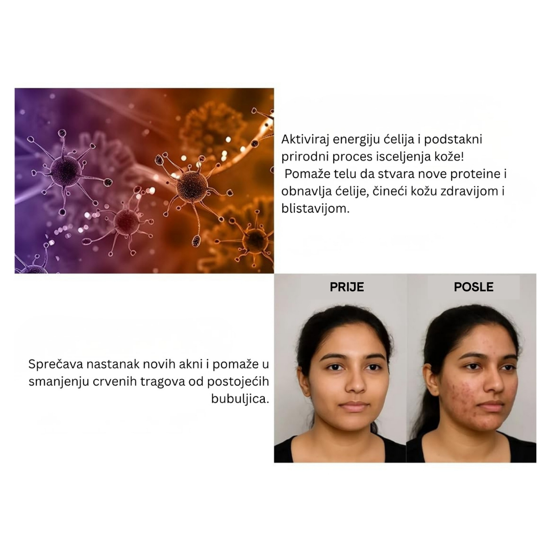 LASERSKA OLOVKA ZA DERMATOLOŠKE PROBLEME